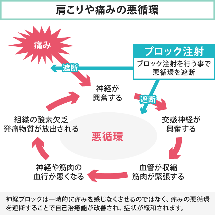 ブロック注射